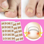 Glue Free Toenail Patch