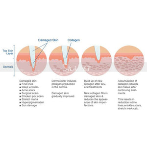 Facial® - Facial Dermaroller Beauty Massage Tool