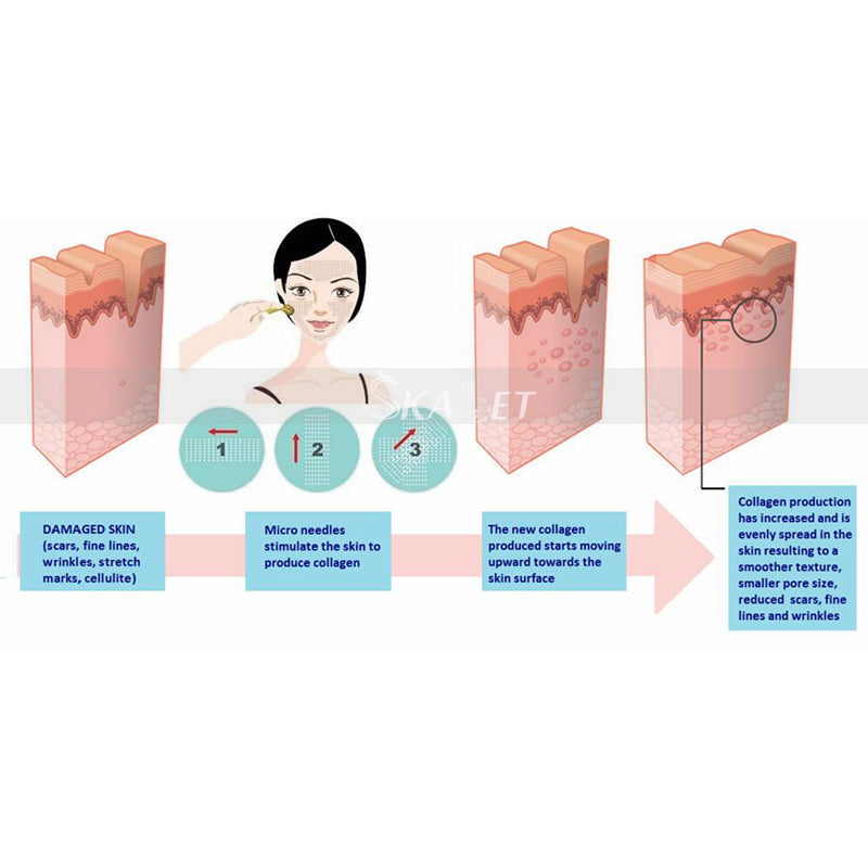 Facial® - Facial Dermaroller Beauty Massage Tool